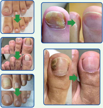 (COMPRA 1 Y LLEVA 3) GlowSkin - Base de Alta Cobertura (Cópia)